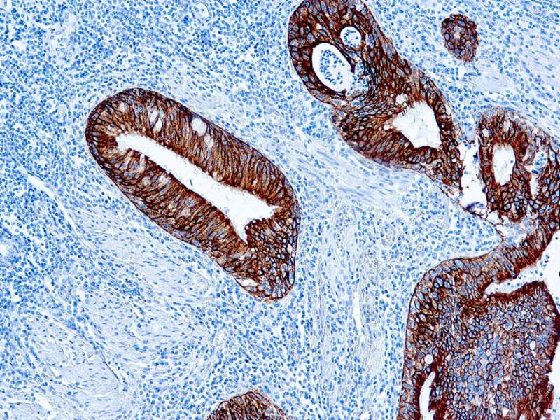 Cytokeratin Ae1 Ae3 Diagnostic Biosystems Immunohistochemistry Primary Antibodies