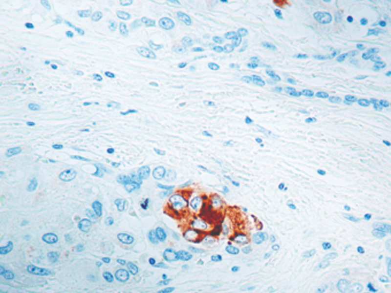 α Fetoprotein (AFP) Diagnostic BioSystems Immunohistochemistry