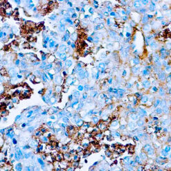Formalin fixed paraffin embedded human liver stained with Albumin