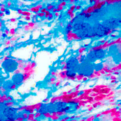 Human colon stained with Alcian Blue (KT002).