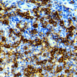 Formalin fixed paraffin embedded human tonsil stained with CD138.