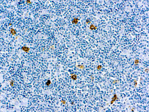 Formalin fixed paraffin embedded human tonsil stained with CD15