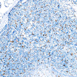 Formalin fixed paraffin embedded human tonsil stained with CD163 antibody.