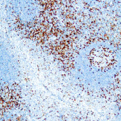 Formalin fixed paraffin embedded human tonsil stained with CD45RO antibody.