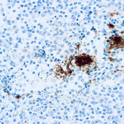 Formalin fixed paraffin embedded human tonsil stained with CD61 antibody
