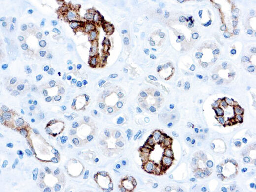 Formalin fixed paraffin embedded human kidney stained with CD63 antibody.