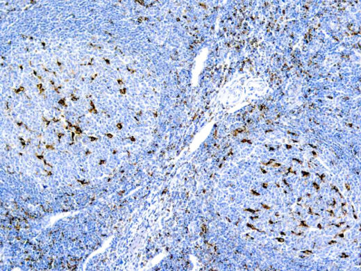 Formalin fixed paraffin embedded human tonsil stained with CD68 Macrophage.