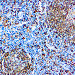 Formalin fixed paraffin embedded human tonsil stained with CD74 antibody.