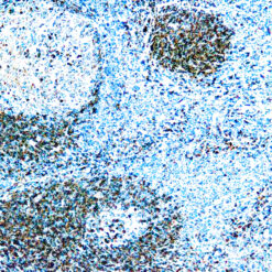 Formalin fixed paraffin embedded human tonsil stained with CD79a Antigen.