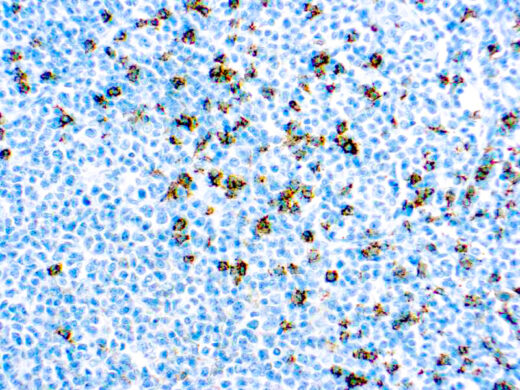 Formalin fixed paraffin embedded human tonsil stained with CD8