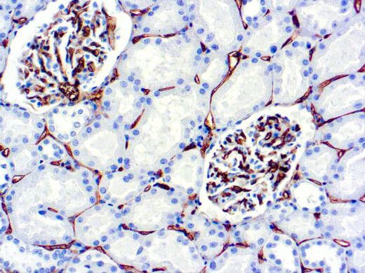 Formalin fixed paraffin embedded human kidney stained with CD34 antibody.