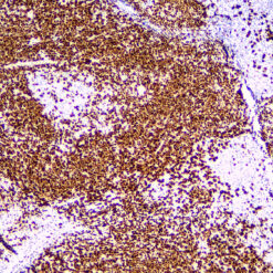 Formalin fixed paraffin embedded human Breast stained with Cyclin D1.