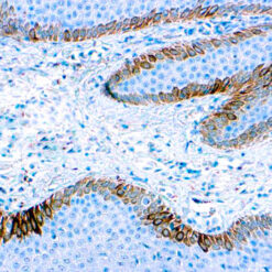 Formalin fixed paraffin embedded human skin stained with Cytokeratin 15 antibody