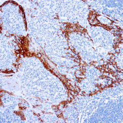Formalin fixed paraffin embedded human tonsil stained with Cytokeratin 16 antibody