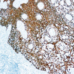 Formalin fixed paraffin embedded human tonsil stained with Cytokeratin antibody