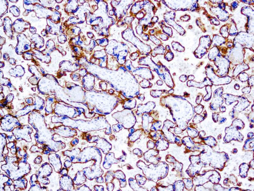 Formalin fixed paraffin embedded human placenta stained with EGFR antibody.