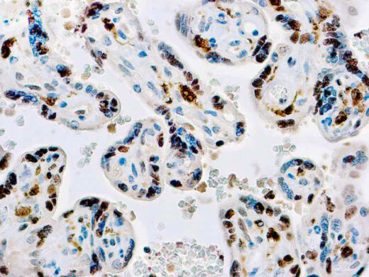 Formalin fixed paraffin embedded human placenta stained with Factor XIII-A antibody.