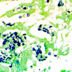 Human lung stained with G.M.S. kit (KT015).