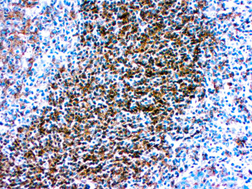 Formalin fixed paraffin embedded human tonsil stained with with HLA-DR antibody.