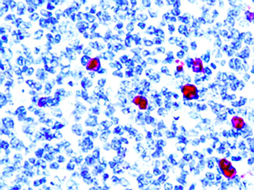 Formalin fixed paraffin embedded human tonsil stained with IgM antibody.