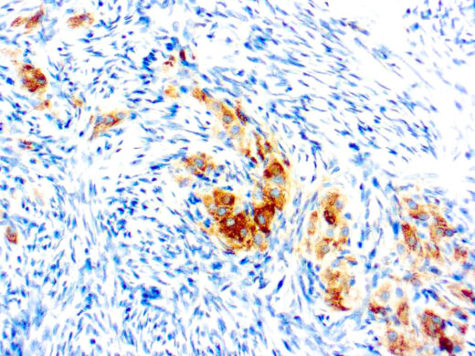 Formalin fixed paraffin embedded human ovary stained with Inhibin α antibody.