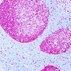 Formalin fixed paraffin embedded human tonsil stained with Ki-67 antibody