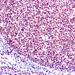 Formalin fixed paraffin embedded human tonsil stained with Ku(p70) antibody