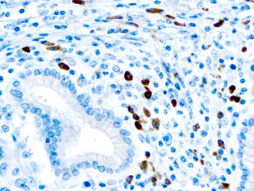 Formalin fixed paraffin embedded human tonsil stained with Lambda Light Chain antibody.