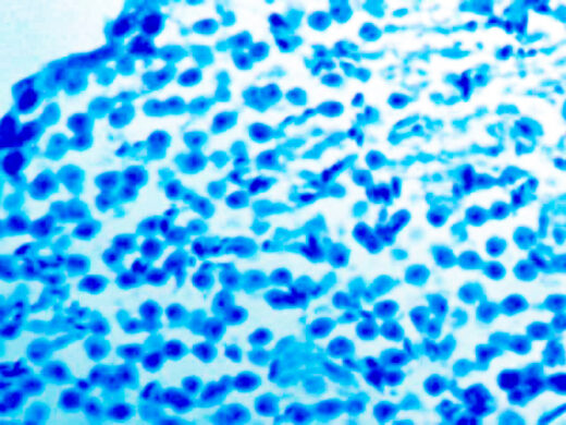 Luxol Fast Blue stain on brain (KT022).