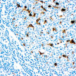 Formalin fixed paraffin embedded human tonsil stained with Lysozyme antibody