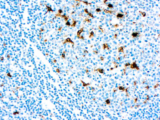 Formalin fixed paraffin embedded human tonsil stained with Lysozyme antibody
