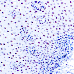 Formalin fixed paraffin embedded human tonsil stained with ERCC1 antibody.