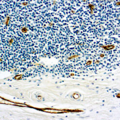 Formalin fixed paraffin embedded human tonsil stained with Factor VIII antibody.
