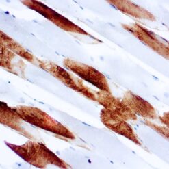 Formalin fixed paraffin embedded human skeletal muscle stained with Myosin antibody