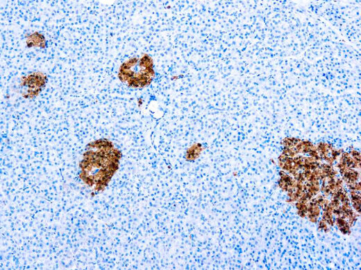 Formalin fixed paraffin embedded human pancreas stained with NSE antibody.