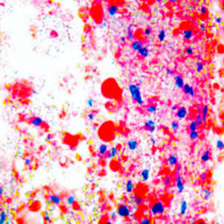 Frozen breast tissue stained with Oil Red O (KT025).