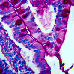 Human interstine stained with PAS stain (KT027).