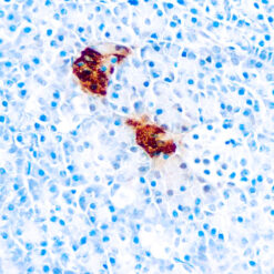Formalin fixed paraffin embedded human pancreas stained with Pancreatic Polypeptide antibody