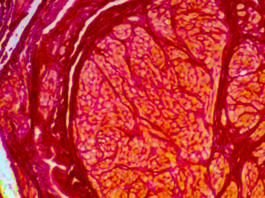 Human uterus stained with Pirco Sirius Red (KT037)