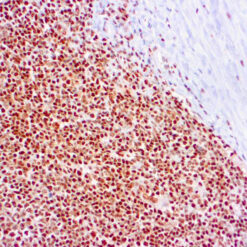 Formalin fixed paraffin embedded human tonsil stained with RPA/p34 antibody