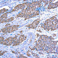 Formalin fixed paraffin embedded human testis stained with Rad51.