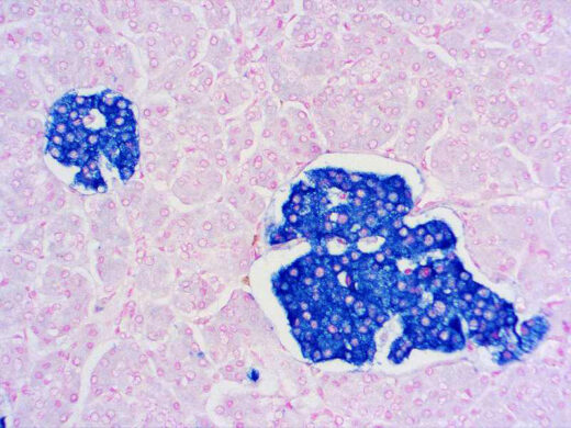 Formalin fixed paraffin embedded human pancreas stained with Synaptophysin antibody.