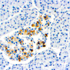 Formalin fixed paraffin embedded human pancreas stained with TIMP-2 antibody