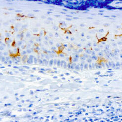 Formalin fixed paraffin embedded human tonsil stained with CD1a