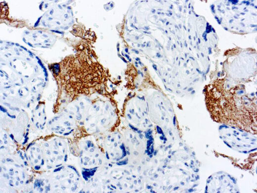 Formalin fixed paraffin embedded human placenta stained with Thrombospodin antibody.