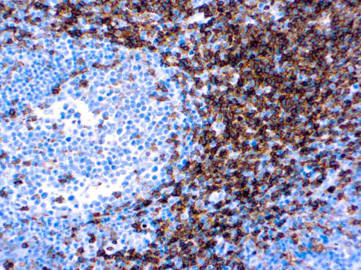 Formalin fixed paraffin embedded human tonsil stained with CD4.