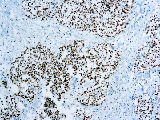Formalin fixed paraffin embedded human testis stained with XRCC1 antibody