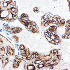 Formalin fixed paraffin embedded human placenta stained with Collagen Type IV antibody.