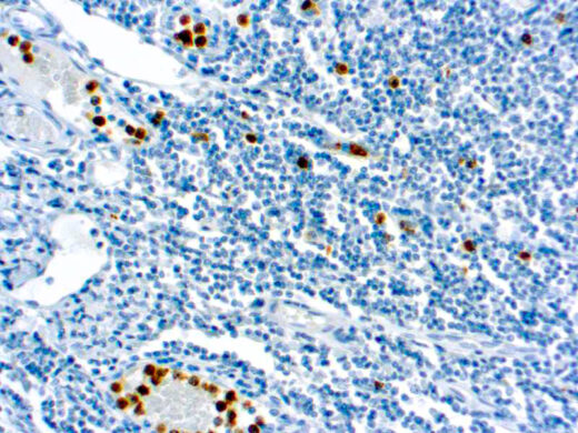 Formalin fixed paraffin embedded human tonsil stained with Myeloperoxidase antibody