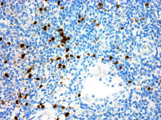 Formalin fixed paraffin embedded human tonsil stained with Tdt antibody